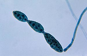 Chain of conidia of an Alternaria sp. fungus PHIL 3963 lores