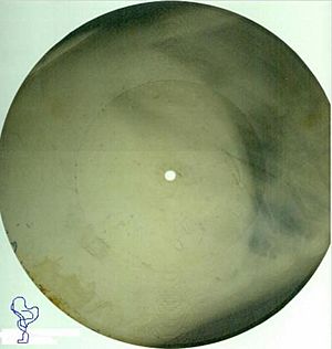 X ray record