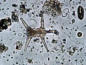 Staurastrum paradoxum EPA