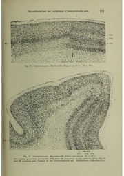Vergleichende Lokalisationslehre der Grosshirnrinde in ihren Prinzipien dargestellt auf Grund des Zellenbaues.pdf
