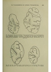 Vergleichende Lokalisationslehre der Grosshirnrinde in ihren Prinzipien dargestellt auf Grund des Zellenbaues.pdf