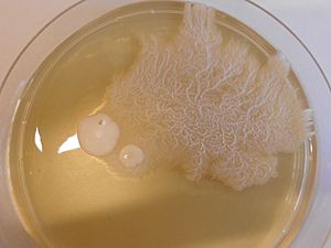 Candida albicans growing as yeast cells and filamentous (hypha) cells