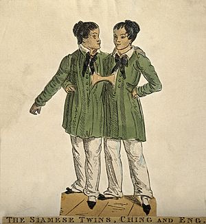 Chang and Eng the Siamese twins. Coloured etching. Wellcome V0007367