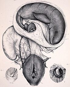 Orcaella foetus