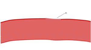 Platelet Response Animation