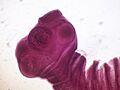 Taenia solium scolex