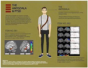 The Amygdala & PTSD