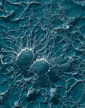 Staphylococcus aureus, 50,000x, USDA, ARS, EMU