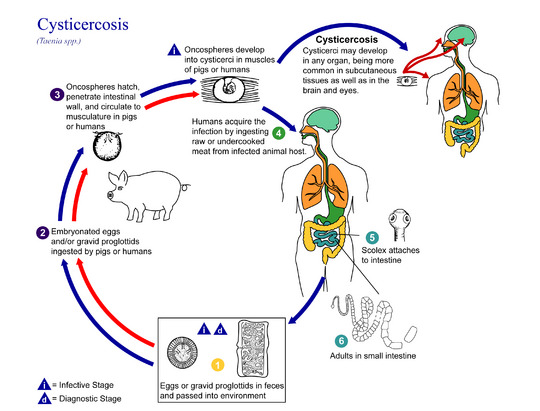 Pork tapeworm Facts for Kids