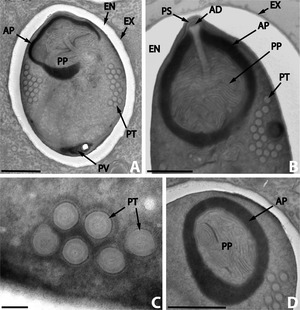 Parasite140019-fig4 Nosema podocotyloidis - Hyperparasitic Microsporidia