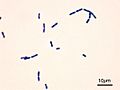 Bacillus cereus Gram