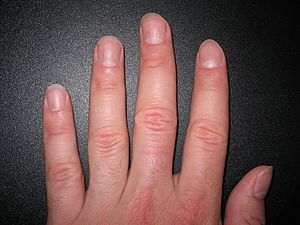 Fingernails2