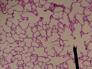 Alveolar sac