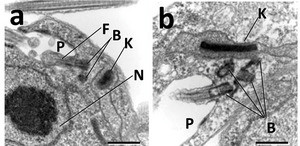 Kinetoplast of Trypanosoma brucei