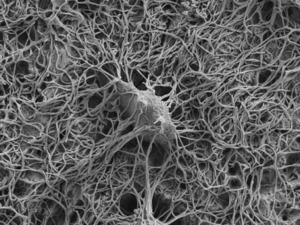 An osteocyte in rat bone exposed by resin cast etching