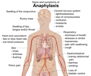 Signs and symptoms of anaphylaxis