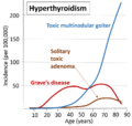 Causes of hyperthyroidism