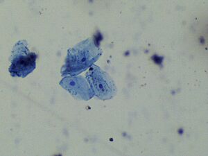 Nucleus in human cheek cells 3