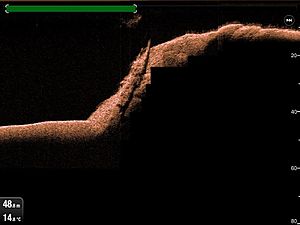 Sonar image of wreck of SS Rondo