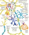 ALS Disease Pathology and Proposed Disease Mechanisms