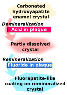 Enamel-fluoride-remineralization