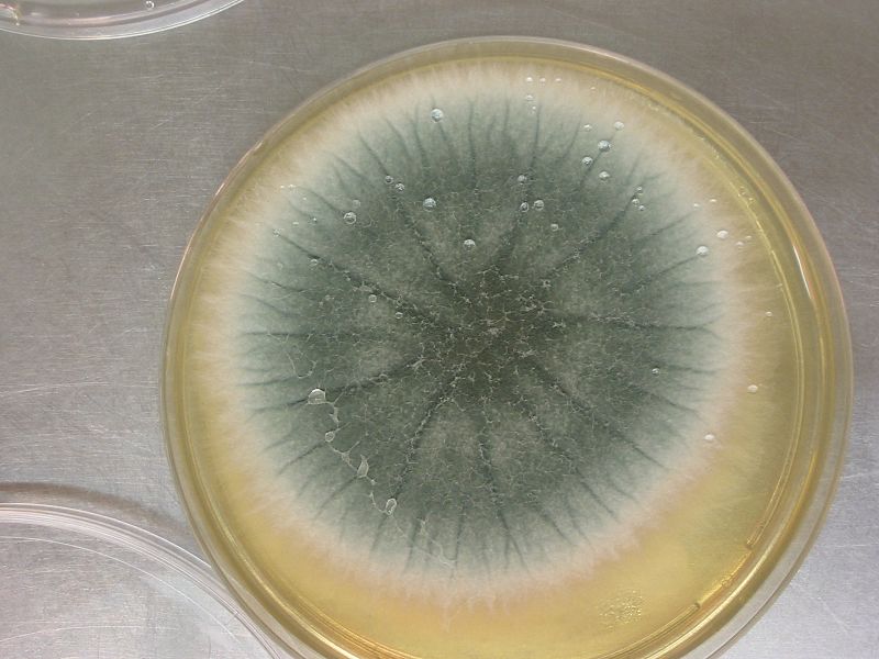 070522-aspergillus 009