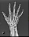 Medical X-Ray imaging VNH07 nevit