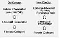 Concepts of IPF