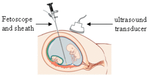 Fetal-endoscope