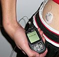 Insulin pump with infusion set