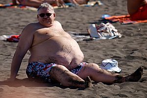 At the beach - male abdominal obesity