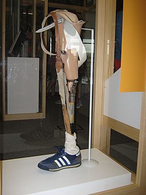 Terry-Fox-prosthesthetic-leg