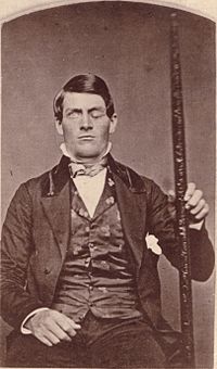 Phineas Gage GageMillerPhoto2010-02-17 Unretouched Color Cropped