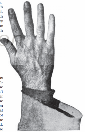 The Hand of Donie Bush