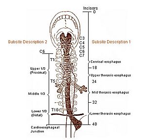 Illu esophagus