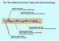 Bio-artificial pancreas with Islet Sheet technology