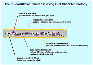 Bio-artificial pancreas with Islet Sheet technology