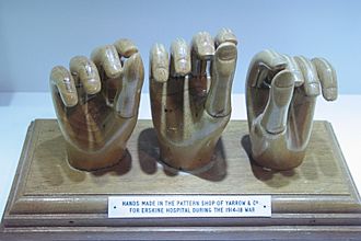 Artificial hands made for Erskine Hospital 1918, Hunterian Museum, Glasgow