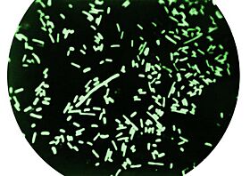 Dark field microscopy revealing Shigella dysenteriae bacteria