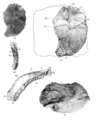 Sinanthropus Skulls IV anf V