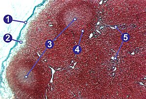Lymphknoten (Schwein)