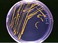 Agar plate with colonies
