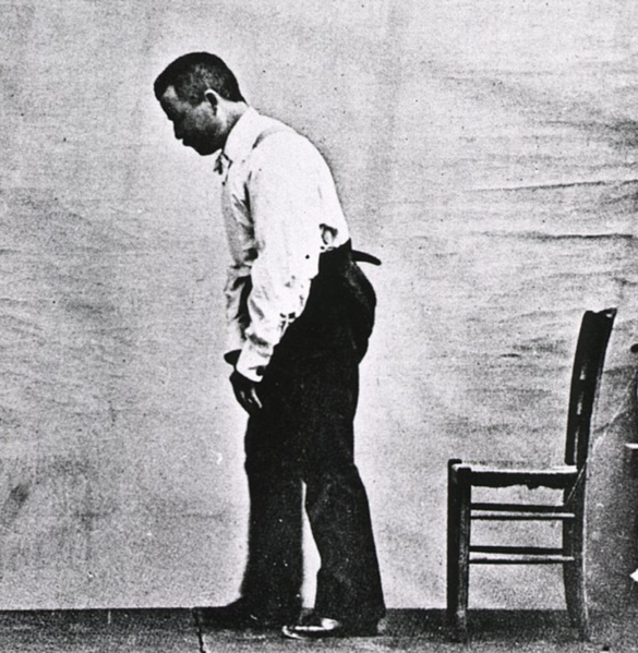 Paralysis agitans-Male Parkinson's victim-1892 cropped