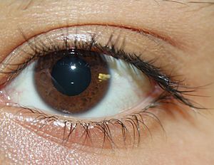 Picture of brown eyes