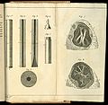 Rene-Theophile-Hyacinthe Laennec (1781-1826) Drawings stethoscope and lungs