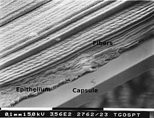 Lens fibre-epithelium-capsule