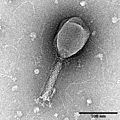 Enterobacteria phage T2 transmission electron micrograph