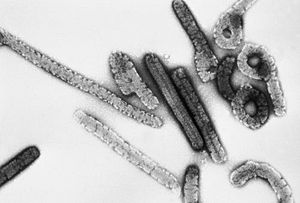 Transmission electron micrograph of Marburg virus