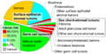 Ovarian tumors by incidence and cancer risk
