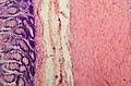 Tissue layers of the small intestine (mucosa, submucosa & muscularis)